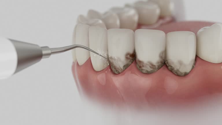 Reliable Invisalign Clear Aligners contractor in Houma, LA by Smile Center Dentistry